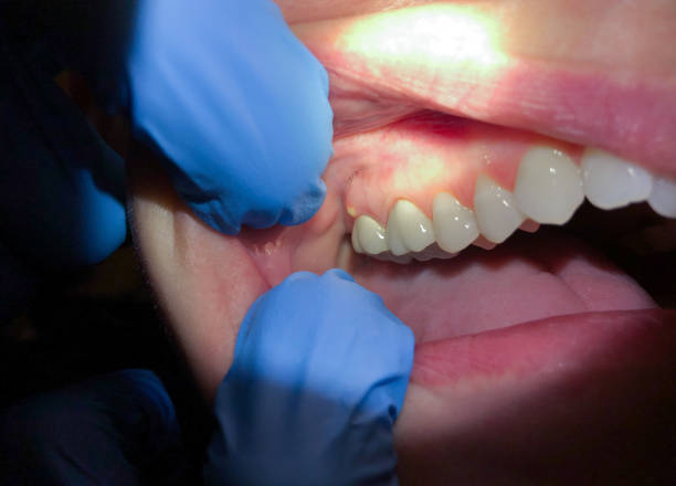 Trusted VT Emergency Dentist Experts